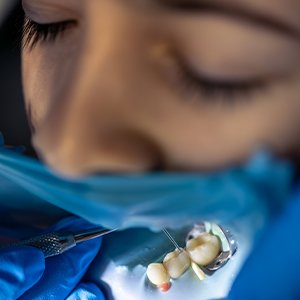 Best Dental Implant Center padmanabhanagar