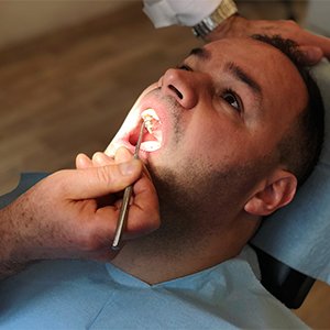 Best Dental Implant Center padmanabhanagar