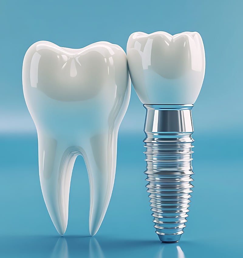 best dental Clinic padmanabhanagar